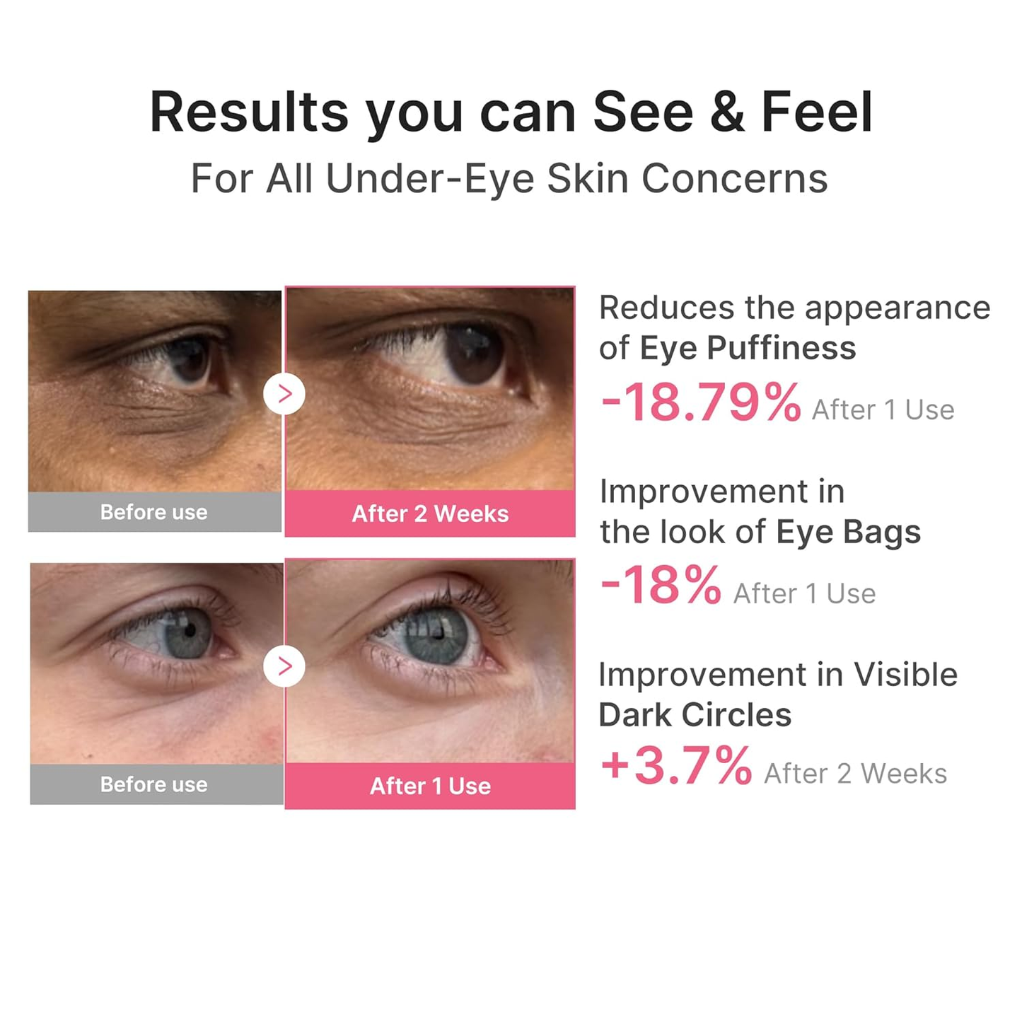 Voppov PDRN Pink Caffeine Collagen Eye Patch – 10-Minute Eye Revival Treatment
